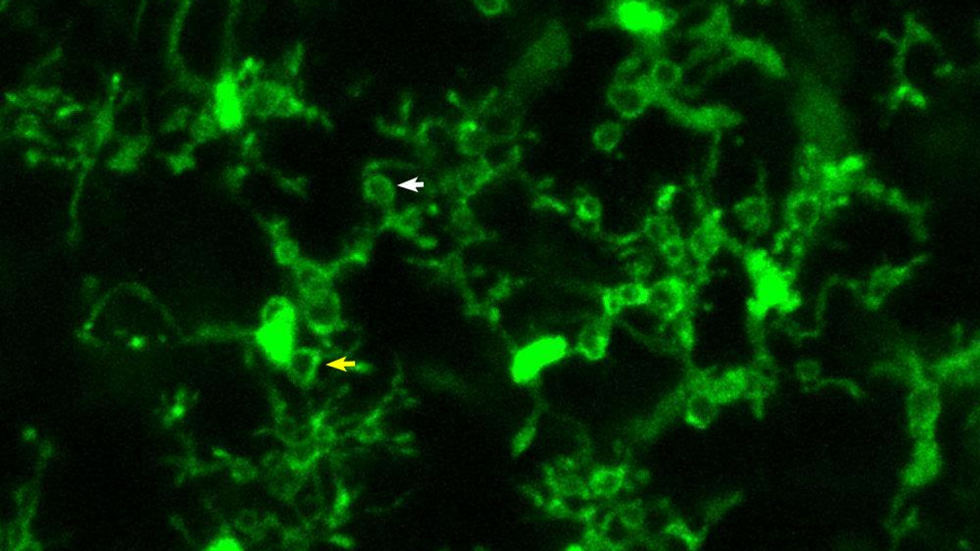 Long-Term Imaging of Microglial Process Pouches Following Seizures Show That They are Stably Maintained for Hours.